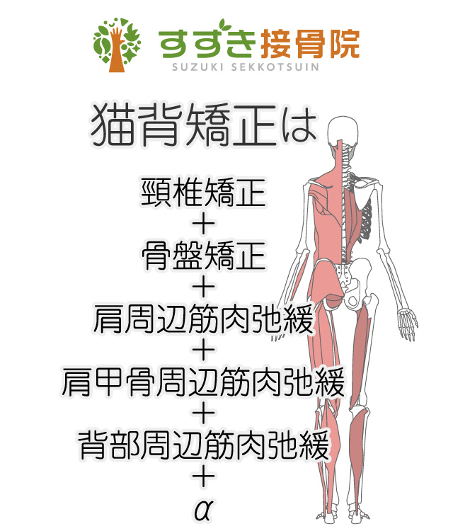 猫背矯正イメージ