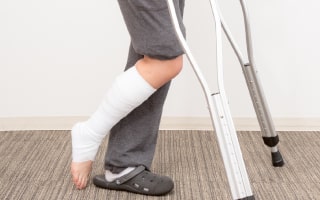 健康保険診療対象となるケガのイメージ